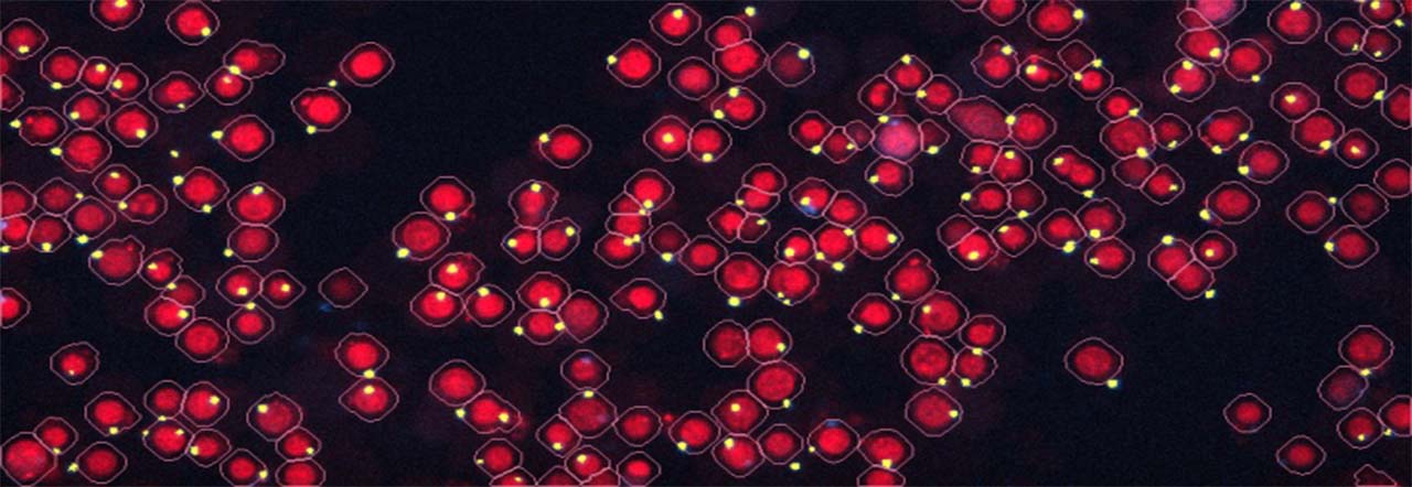 nlr inflammasomes lots copy copy.jpg