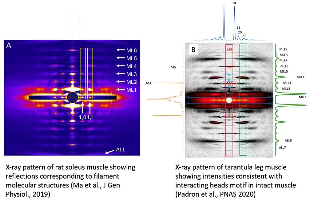 Padr&oacute;n-Craig Lab - UMass Chan - Xray patterns of muscle