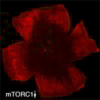 Loss of mTORC by 2 months of age