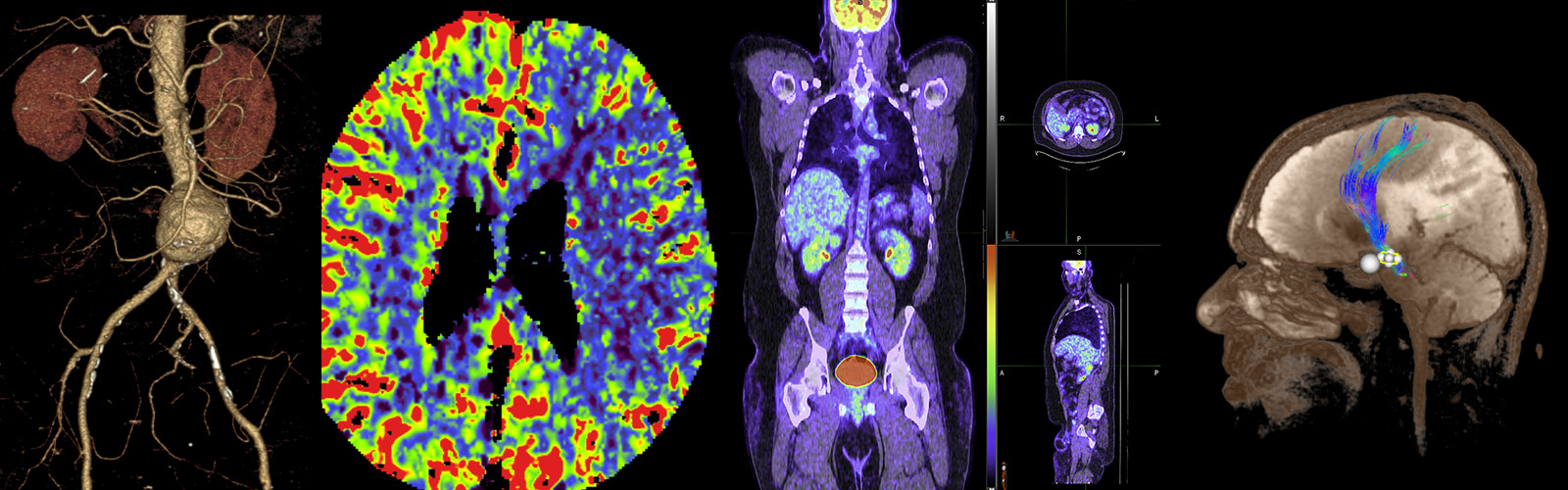 Cutting-edge research